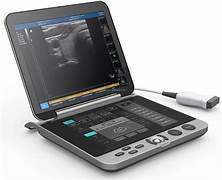 Portable Ultrasound Machine